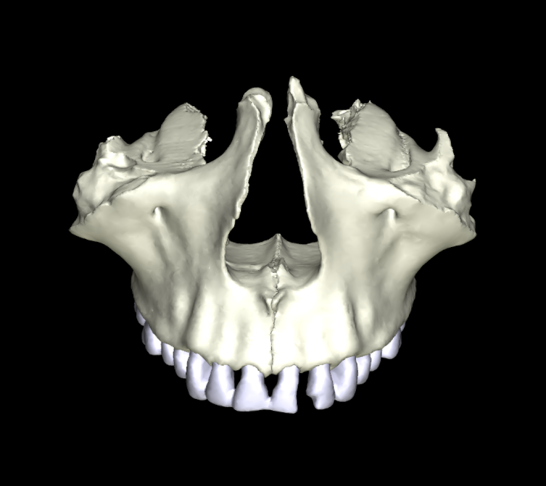 Osso Mascellare 3D Anatomia