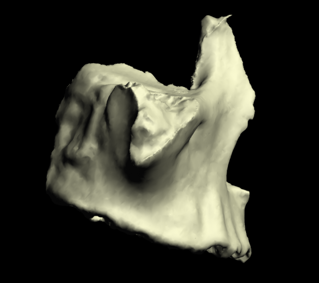 Osso Mascellare 3D Anatomia