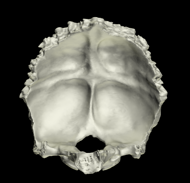 osso occipitale 3d