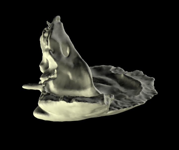 Osso Temporale 3D Anatomia