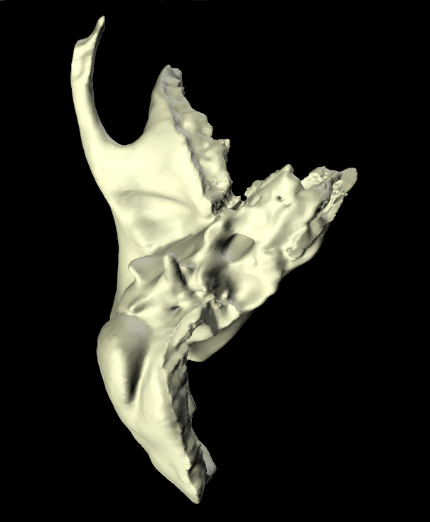 Osso Temporale 3D Anatomia