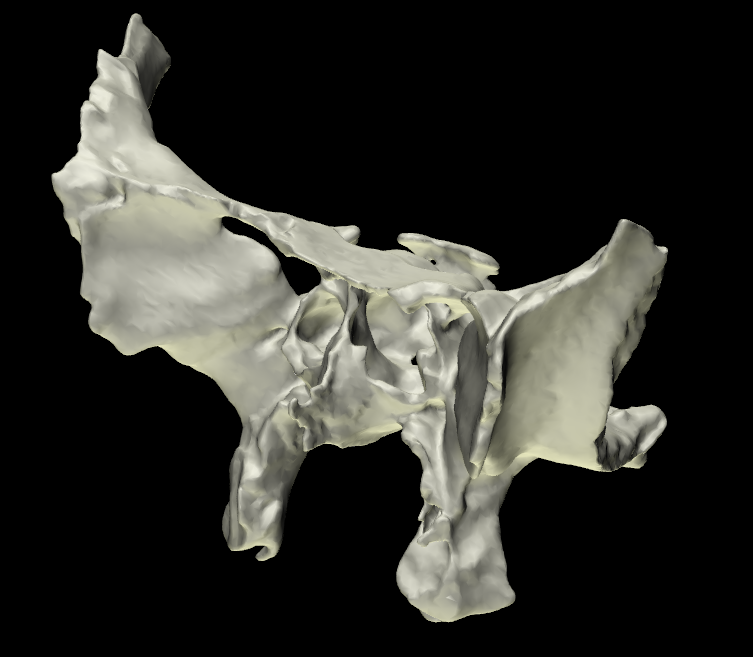 Osso Sfenoide 3D Anatomia