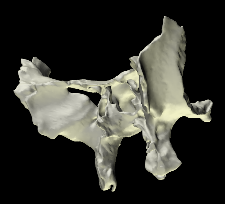 Osso Sfenoide 3D Anatomia