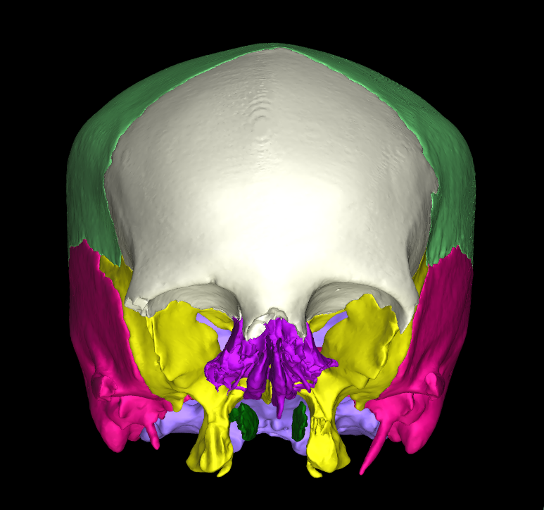 cranio 3d