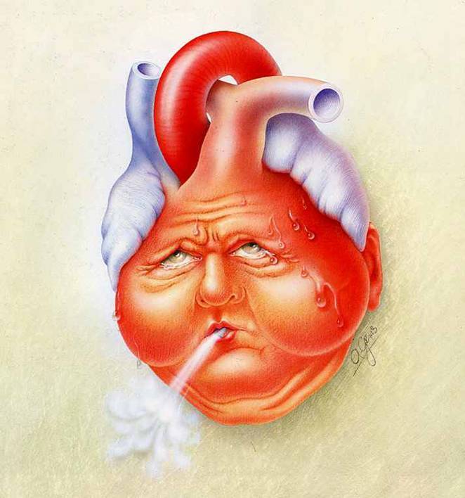 Definizione di insufficienza cardiaca